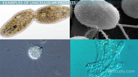  Chilomonas: ¡Un Protista Unicelular Que Se Mueve con Estilo!